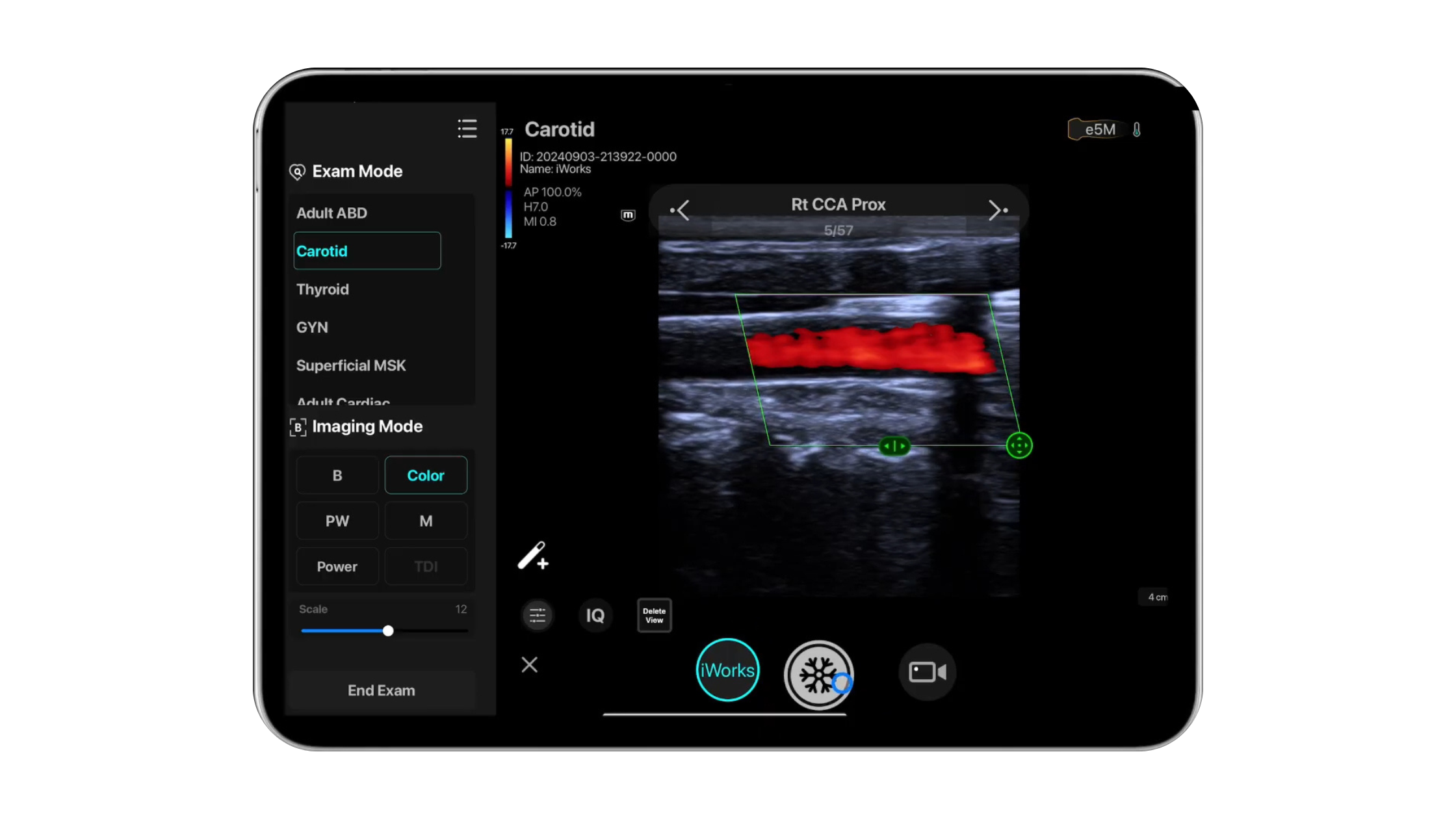 Smarter Scanning: How Built-In Protocols Standardise Every POCUS Exam