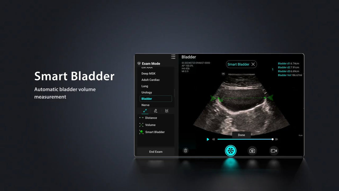 Bladder Scan in 5 steps handheld ultrasound te air