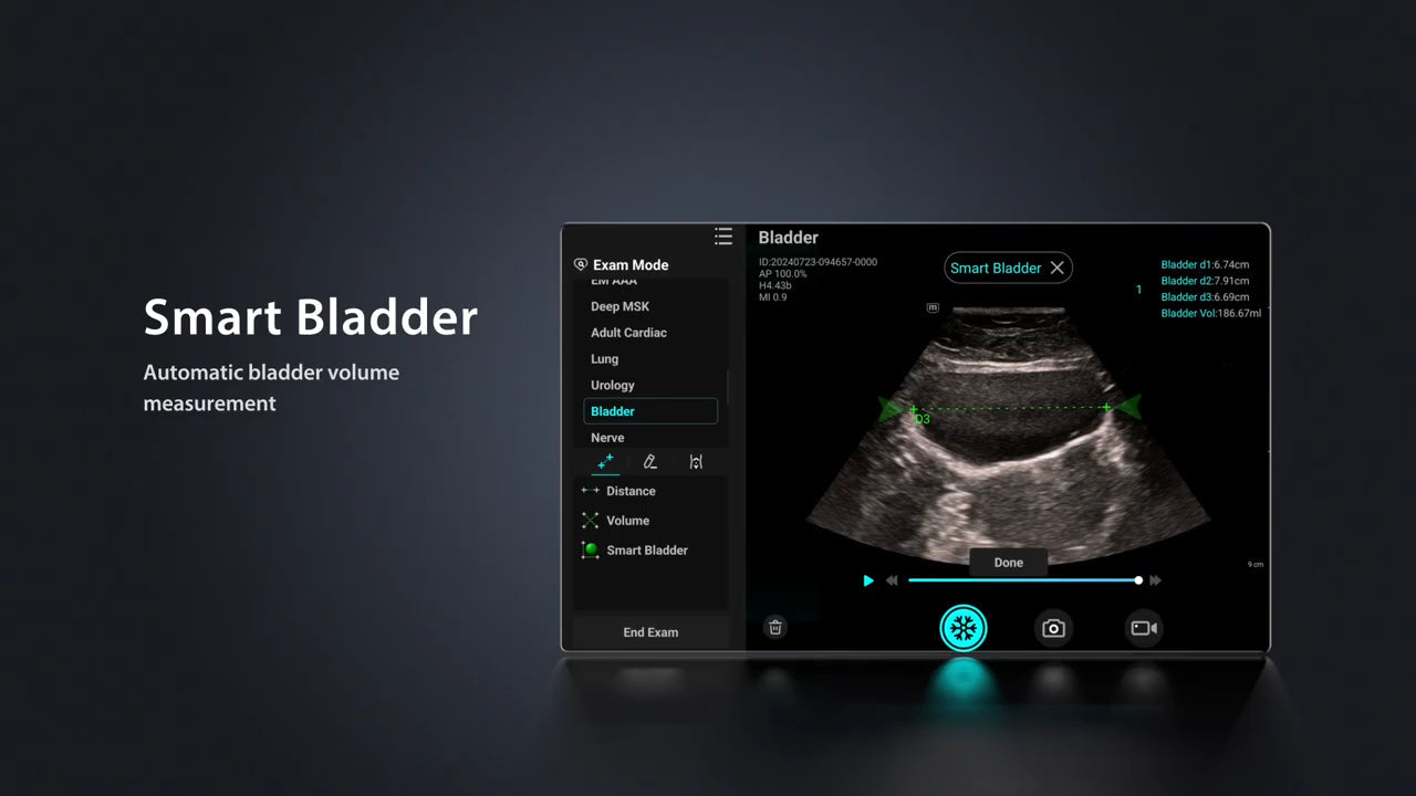 Bladder Scan in 5 steps handheld ultrasound te air