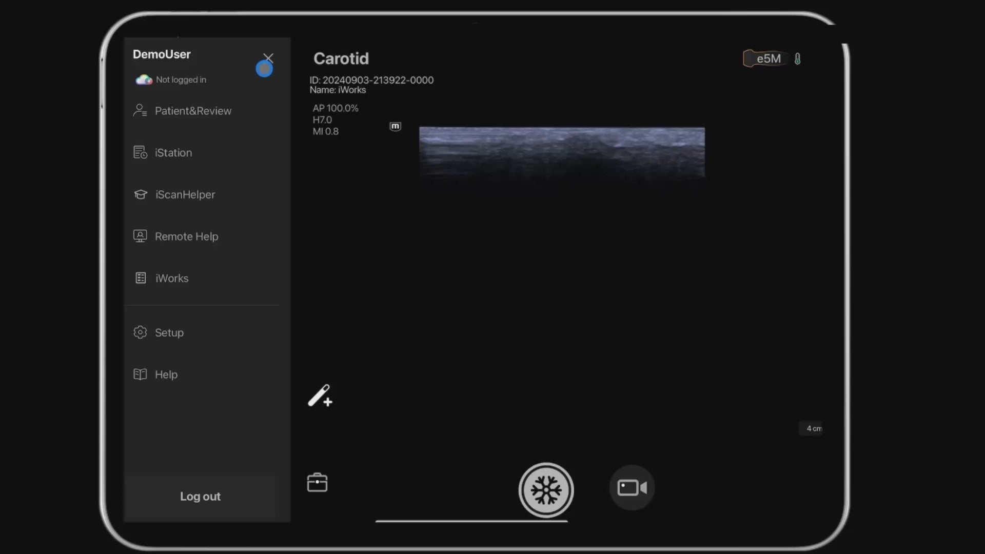 scanning protocols on TE Air handheld portable ultrasound